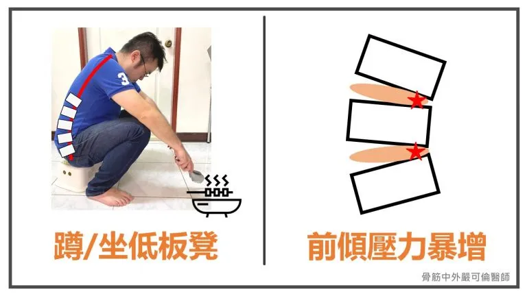 中秋節烤肉，沒拉肚子卻腰痠背痛！？
