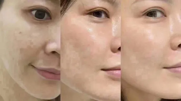 水光