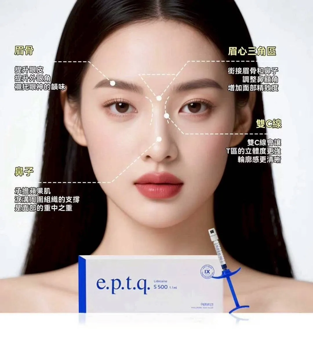 玻尿酸能拉提臉型？玻尿酸注射,台中打玻尿酸