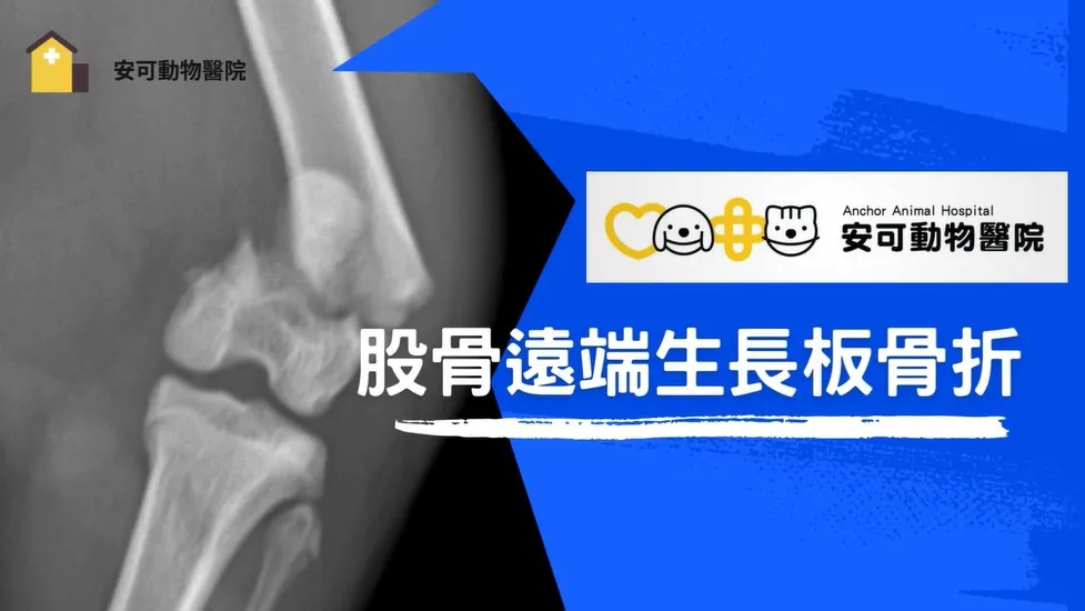 股骨遠端生長板骨折