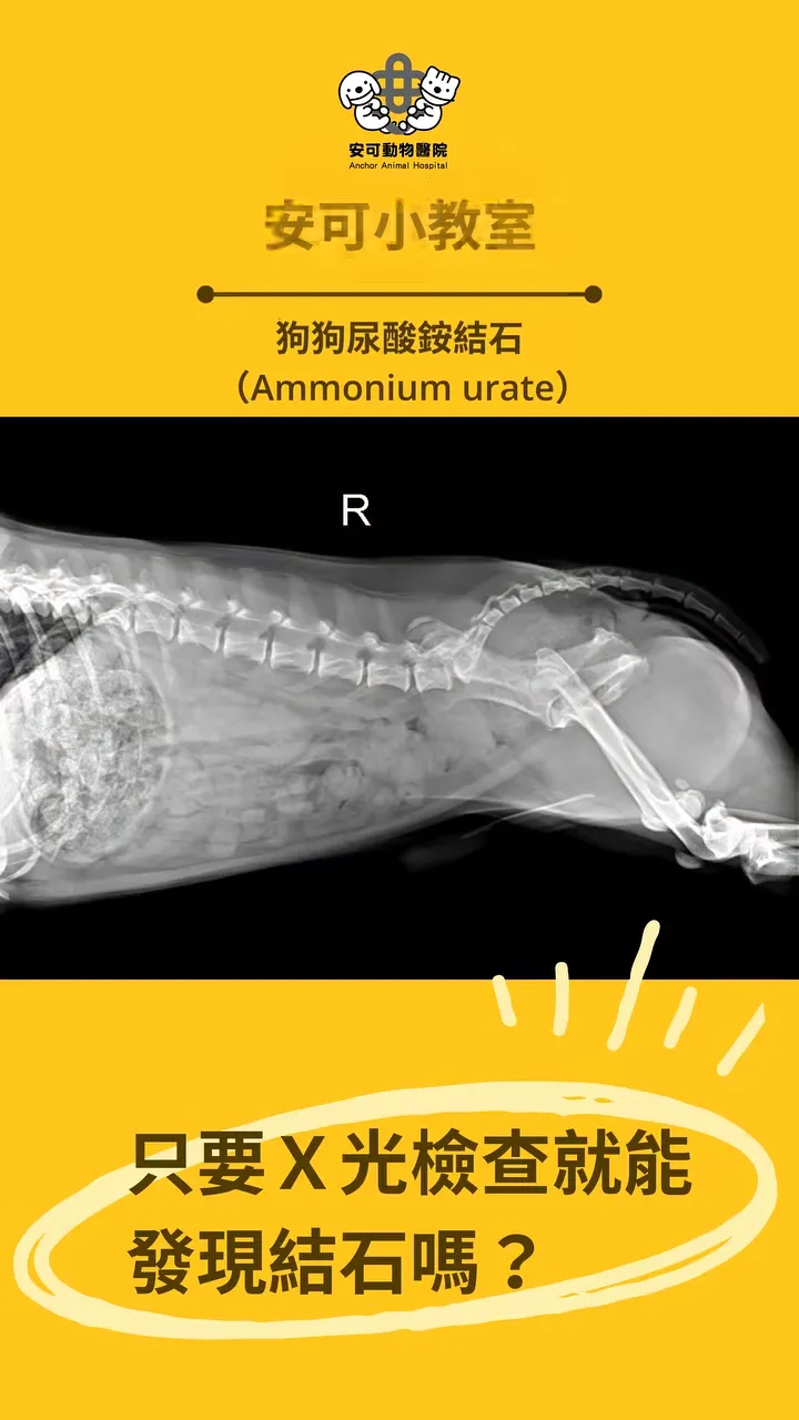 尿酸銨結石（ammonium urate）