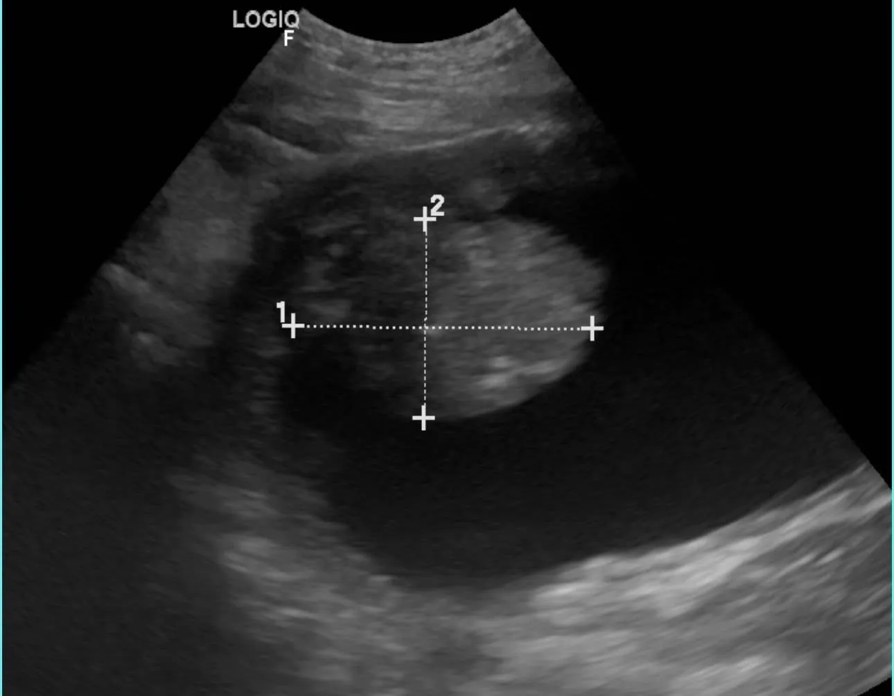 「血尿、頻尿，都是膀胱炎、感染嗎？ 小心隱形殺手膀胱癌！」—犬膀胱癌須知