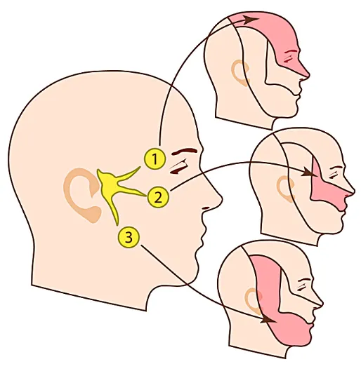 三叉神經痛 之定義、原因、症狀、建議、治療 – 松山景能物理治療所