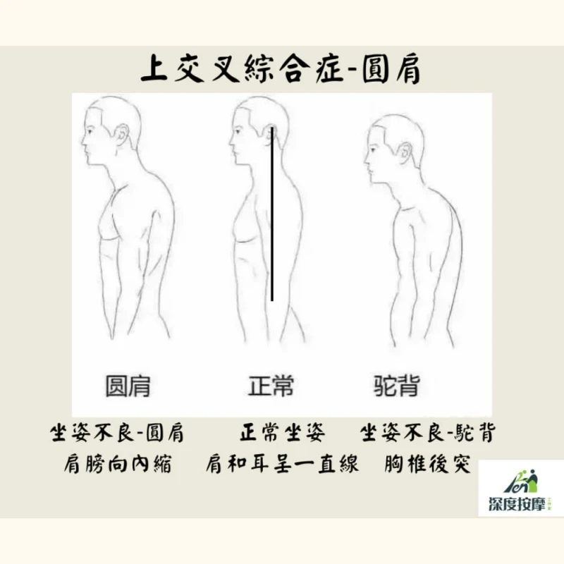 上交叉綜合症-圓肩 | Ren 深度按摩工作室  |新竹運動按摩