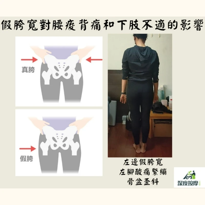 假胯寬對腰痠背痛和下肢不適的影響 | Ren 深度按摩工作室 |  新竹運動按摩