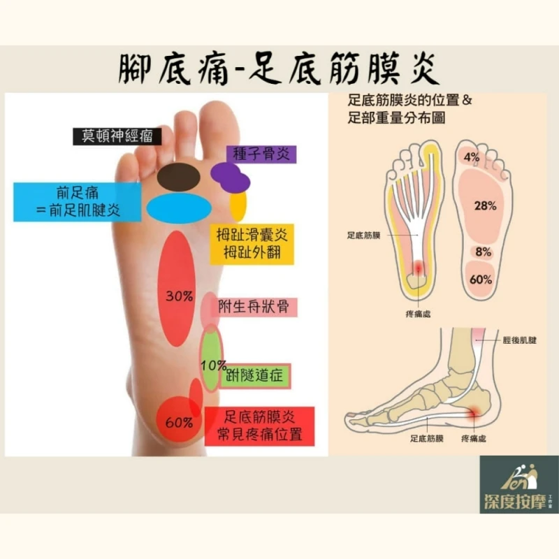 腳底疼痛-足底筋膜炎 | Ren 深度按摩工作室 |  新竹徒手按摩
