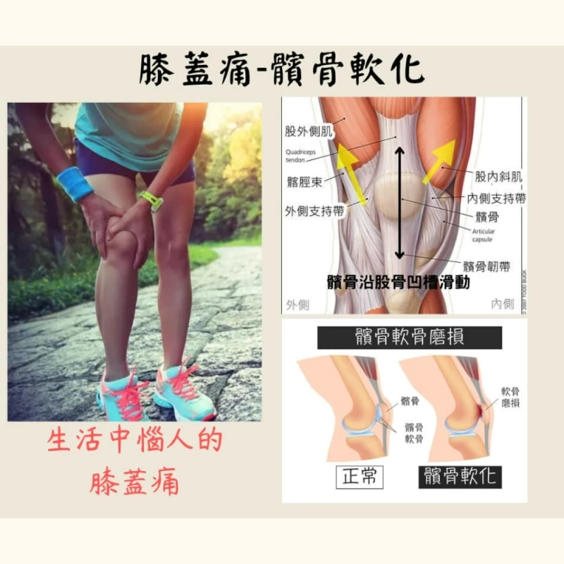 膝蓋痛-髕骨軟化 | Ren 深度按摩工作室 | 新竹徒手按摩