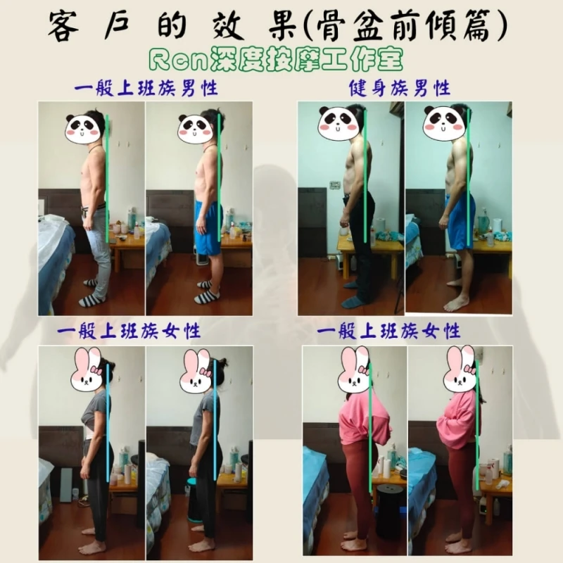 下交叉綜合症-骨盆前傾 | Ren深度按摩工作室 | 新竹運動按摩