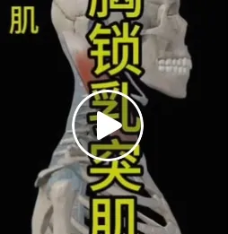 胸鎖乳突肌簡介/運動按摩推薦/高雄肌肉痠痛按摩