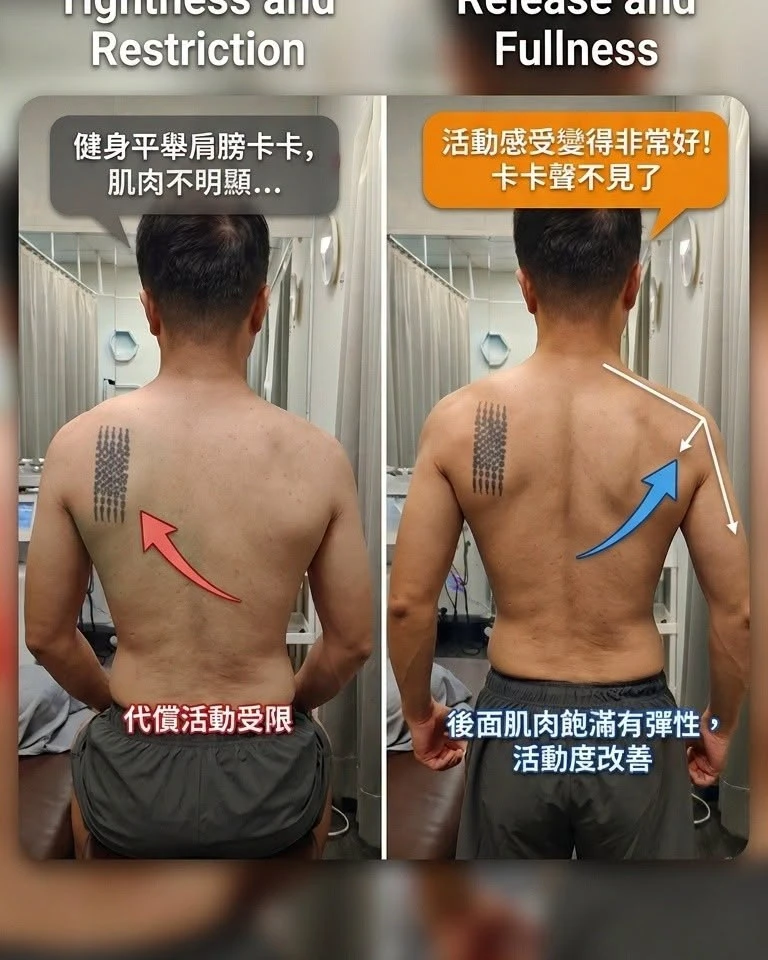 客人：「我練平舉肩膀前面一直卡卡有聲音，後面背也很緊」-高雄體態調整/高雄體態矯正