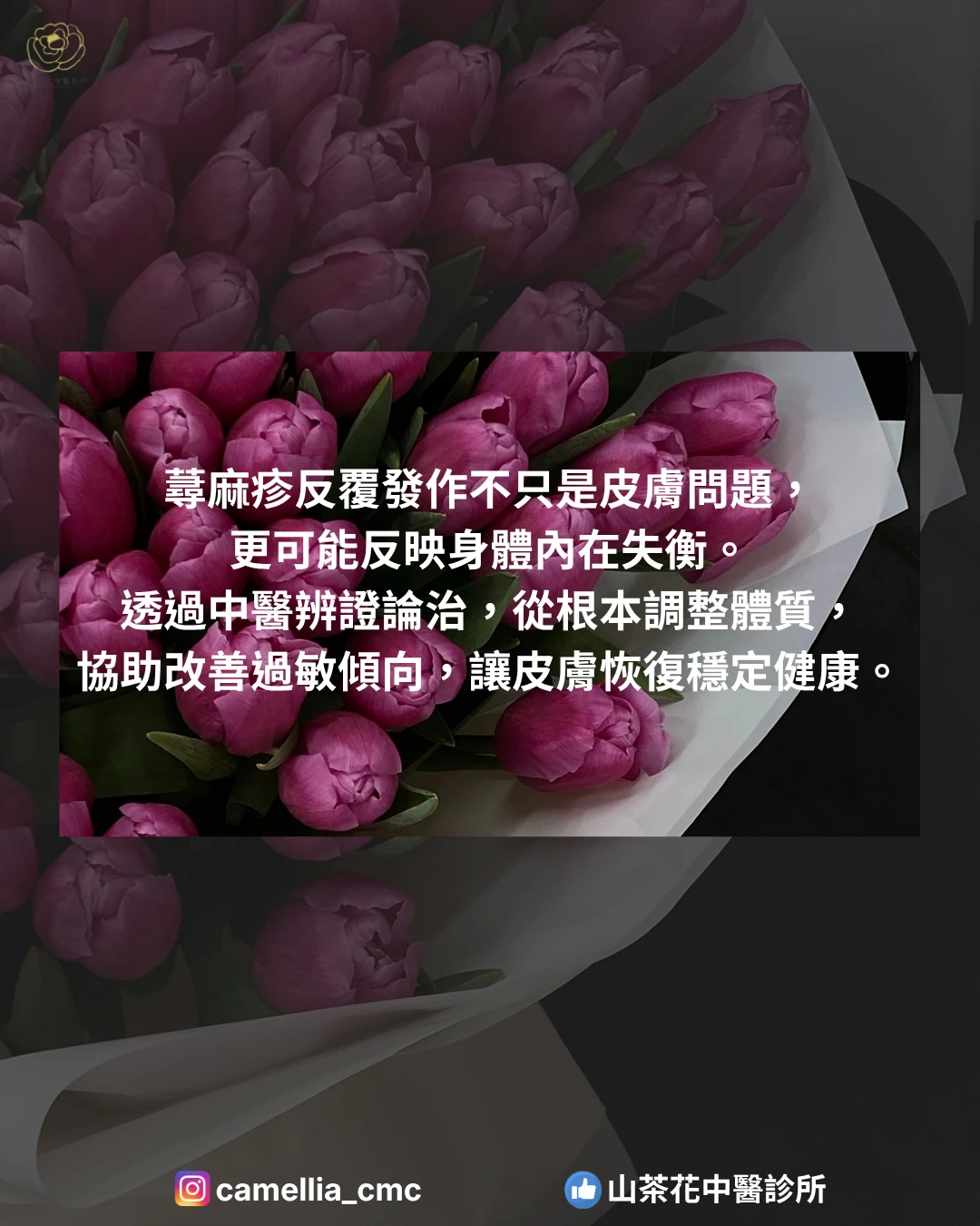 蕁麻疹反覆發作怎麼辦？中醫從體質調理改善過敏問題