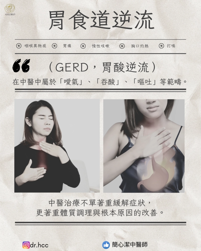 胃食道逆流