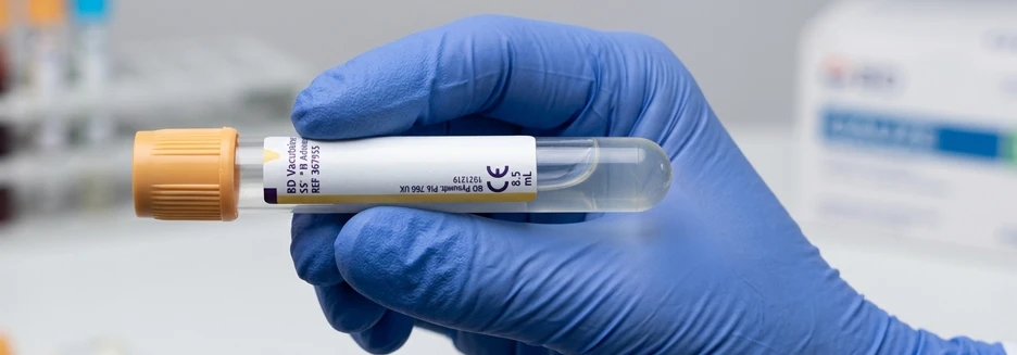 Growth Hormone 生長激素