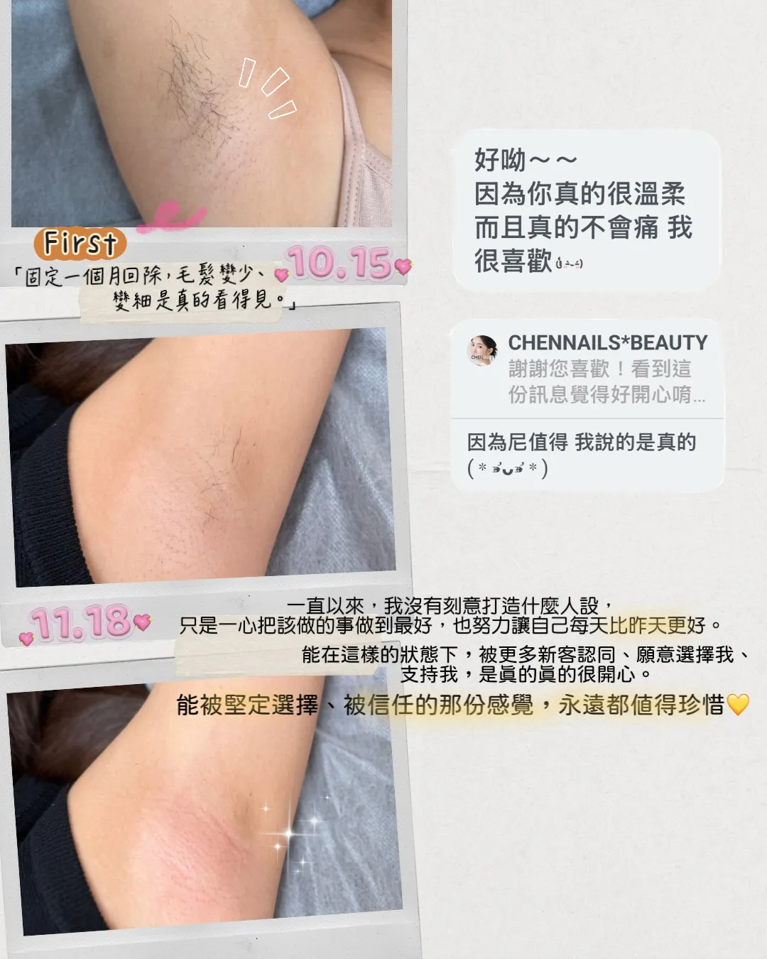 好評回饋｜固定一個月回除,毛髮變少.變細是真的看的見