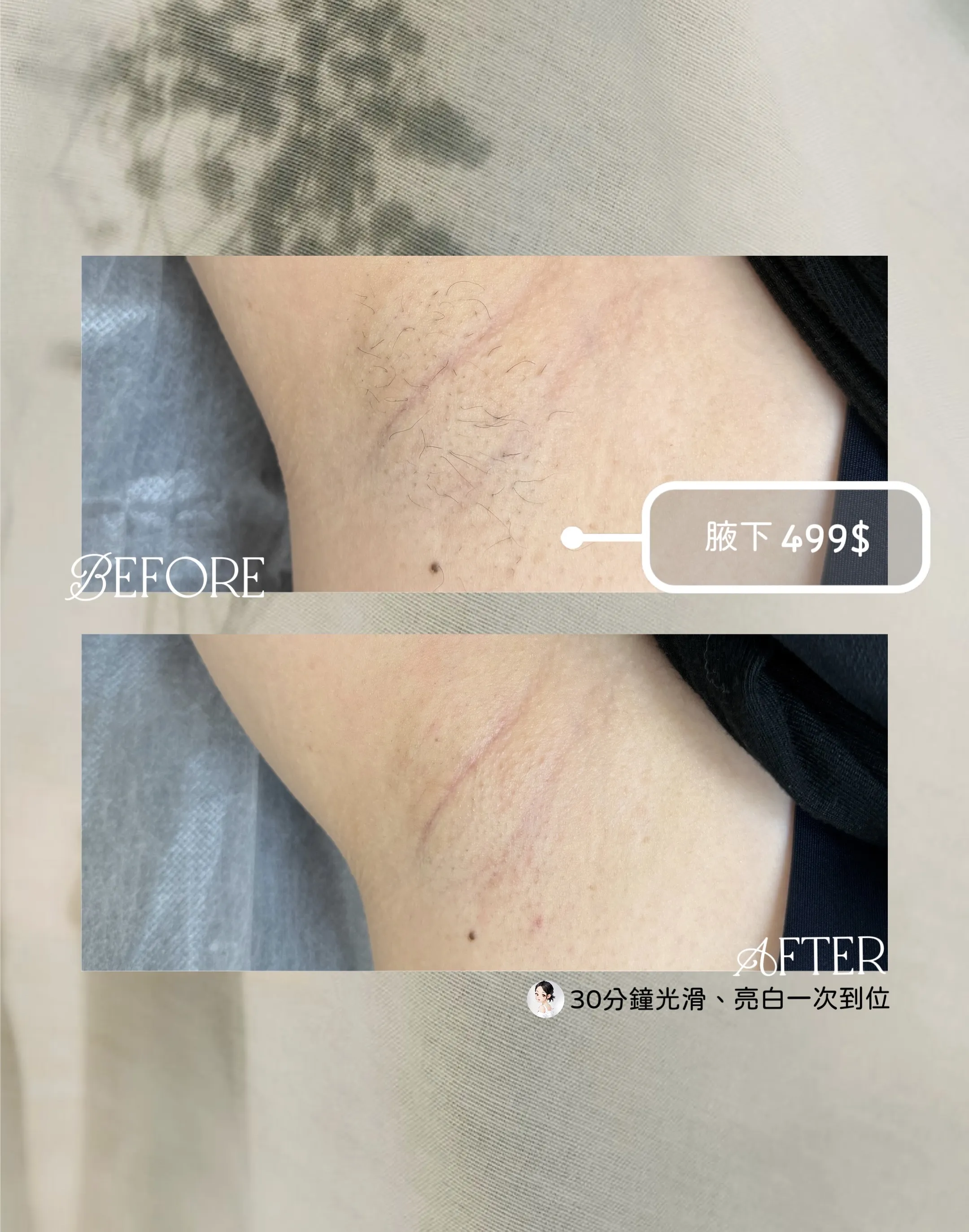 30 分鐘快閃變美｜光滑、亮白、除毛一次到位！【中山區除毛】【台北無痛除毛】