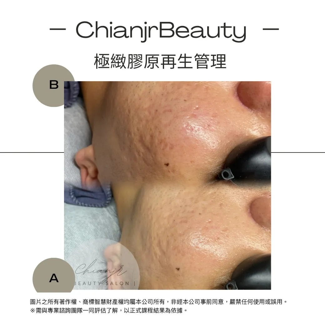 我們會先評估後，才推薦適合您的課程｜彰化皮膚管理｜和美鎮皮膚管理