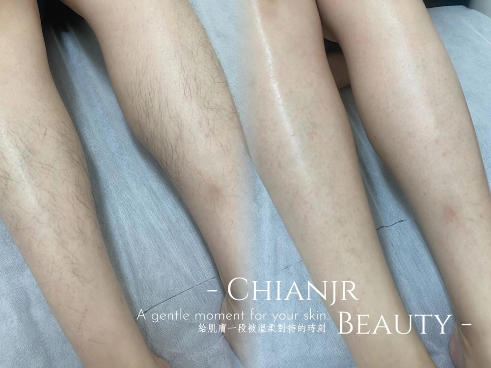 熱蠟美肌