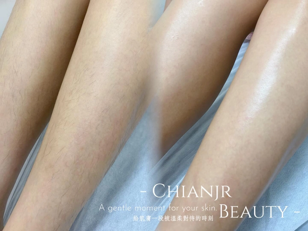 熱蠟美肌