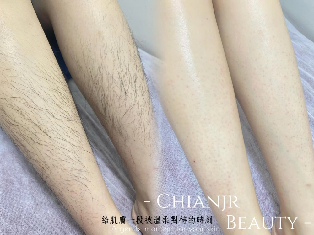 熱蠟美肌