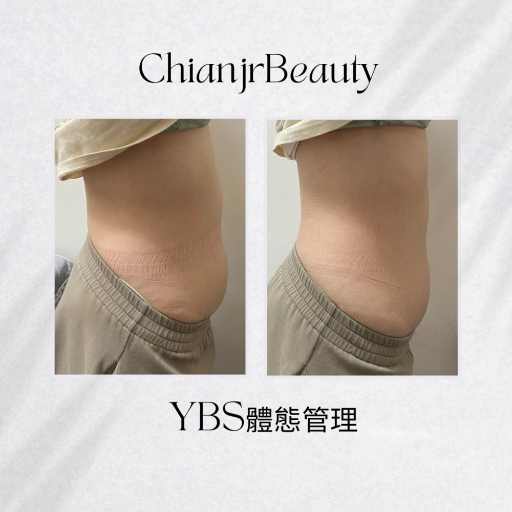 YBS體態管理｜彰化產後腹直肌修復｜和美產後修復