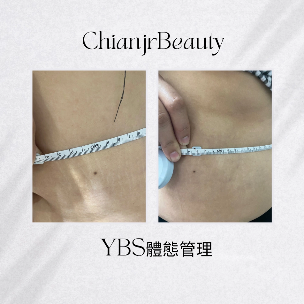 YBS體態管理｜彰化產後腹直肌修復｜和美產後修復