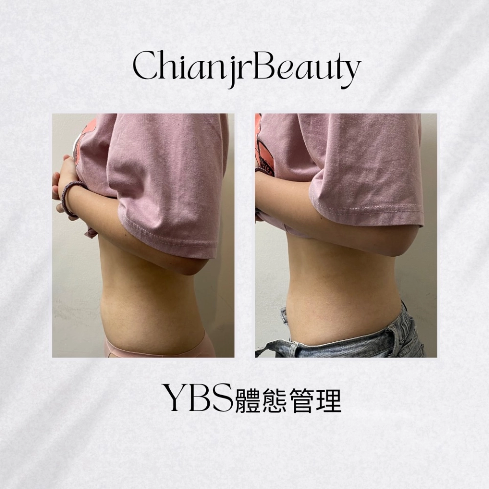 YBS體態管理｜彰化產後腹直肌修復｜和美產後修復
