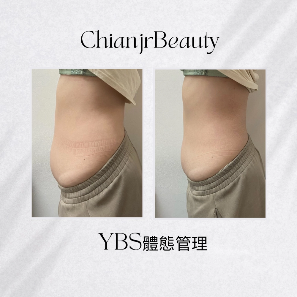 YBS體態管理｜彰化產後腹直肌修復｜和美產後修復