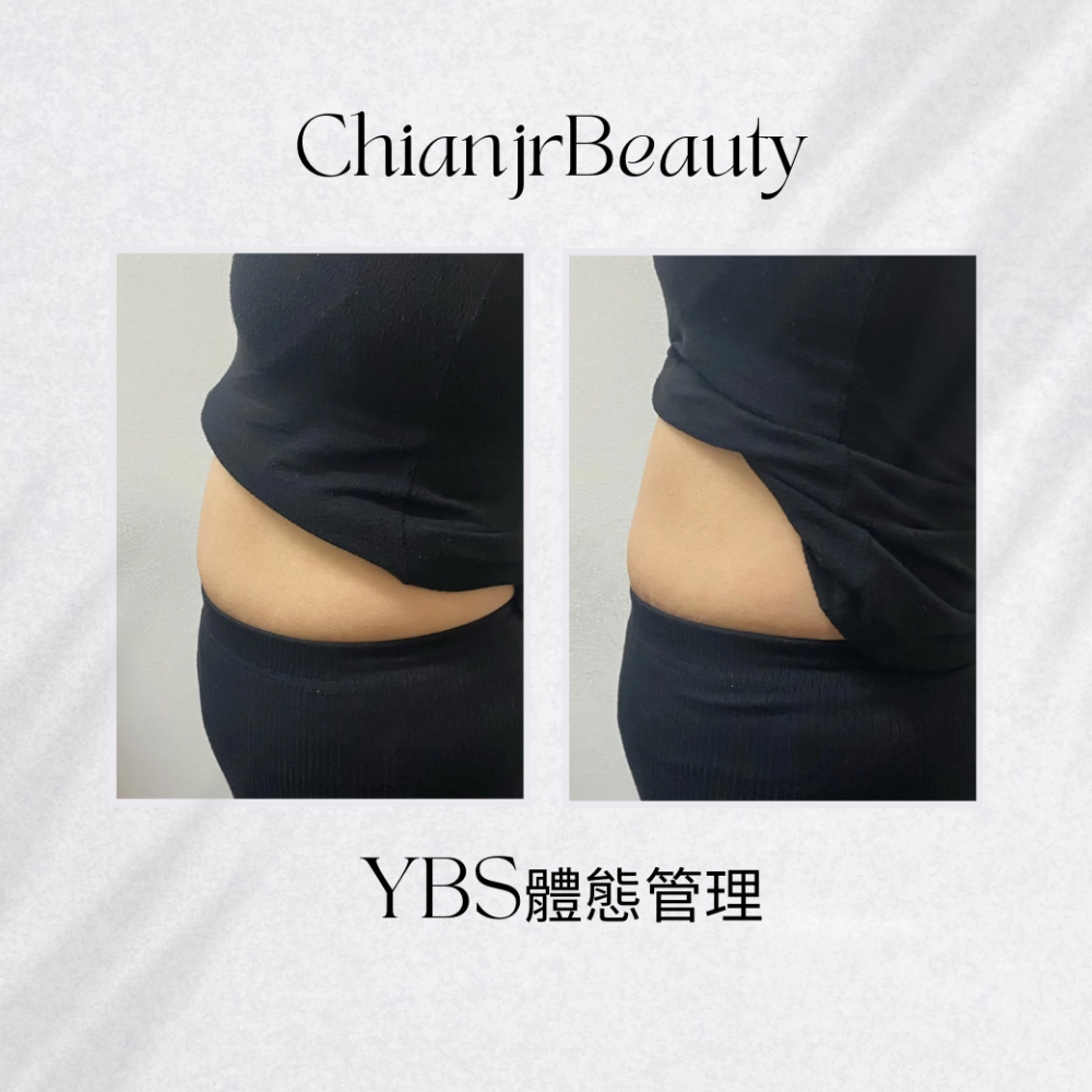 YBS體態管理｜彰化產後腹直肌修復｜和美產後修復