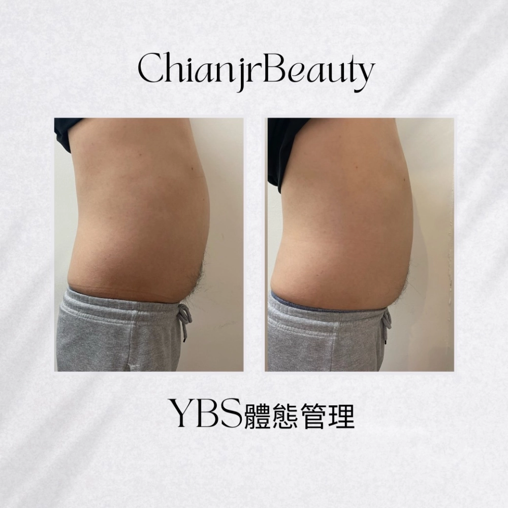 YBS體態管理｜彰化產後腹直肌修復｜和美產後修復