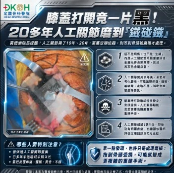 膝蓋打開竟一片黑！20多年人工關節磨到「鐵碰鐵」