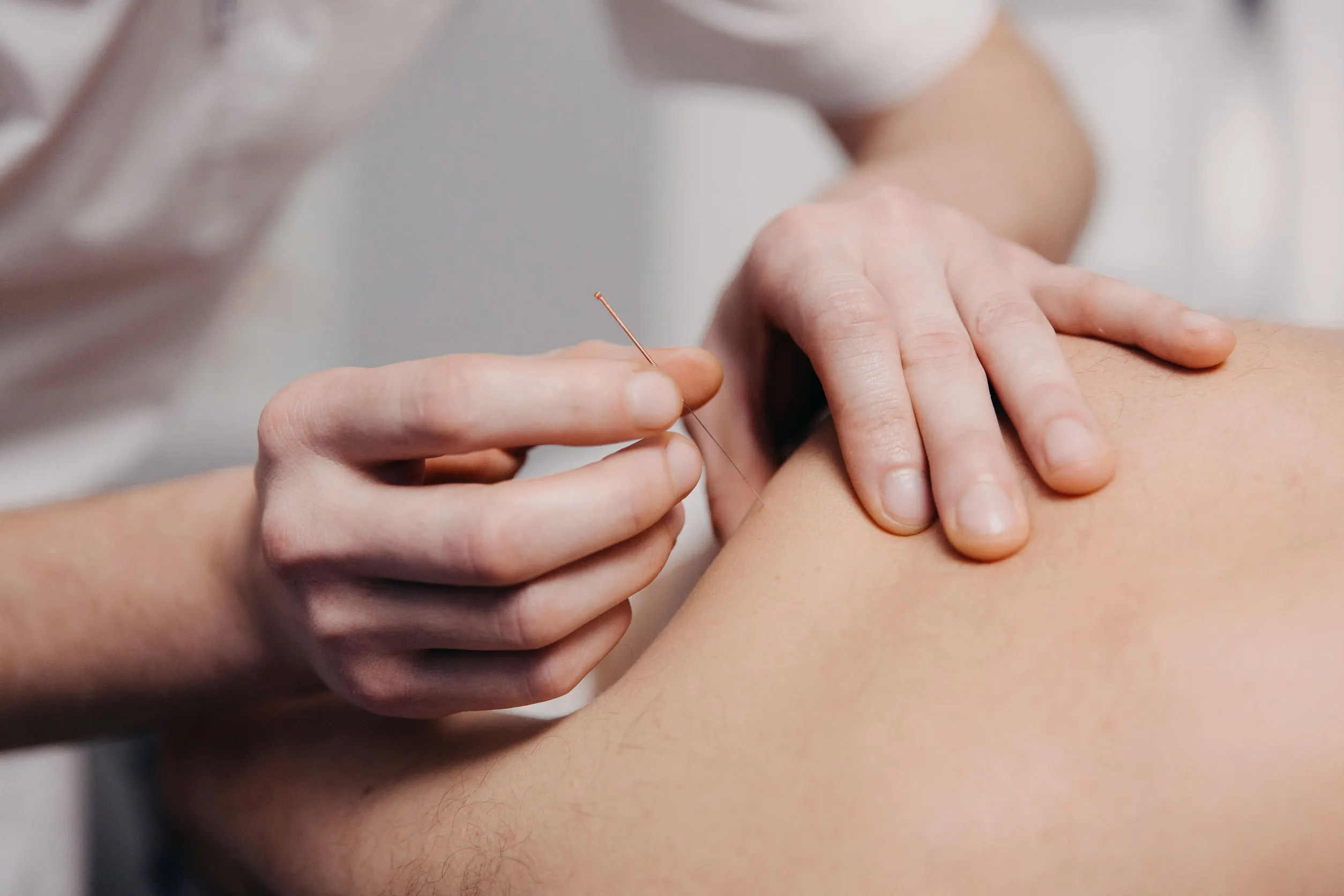 針刀療法 vs 超音波導引針刀：差異、適應症、優勢、風險與常見問題