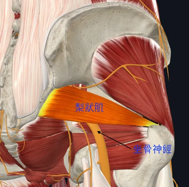 坐骨神經痛中醫治療｜針灸、針刀療法、超音波導引精準治療｜台中沙鹿梧棲