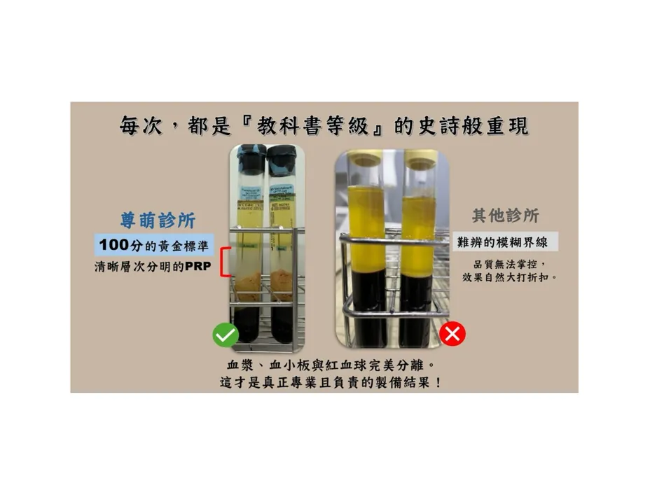 育髮PRP如何選?