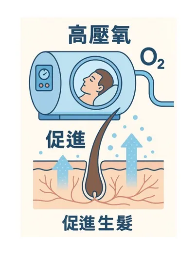 高壓氧與生髮育髮息息相關!!