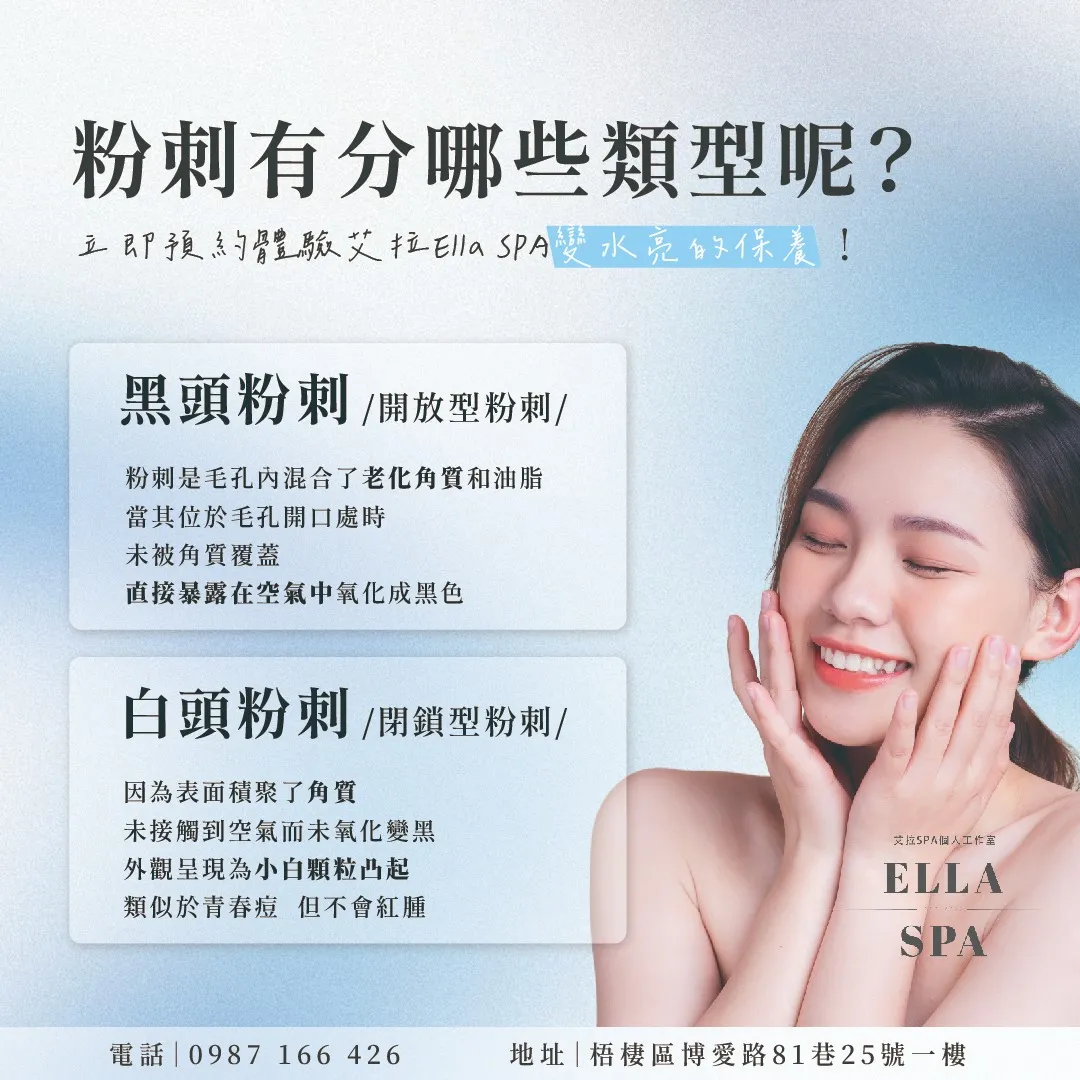 粉刺有分哪些類型呢?