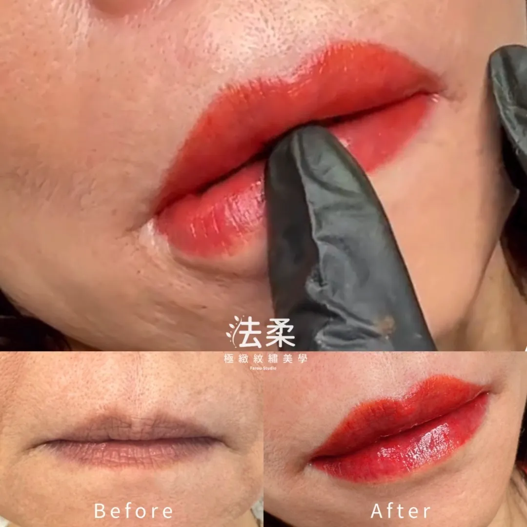 唇緣+唇珠缺角 讓整體唇型不完整