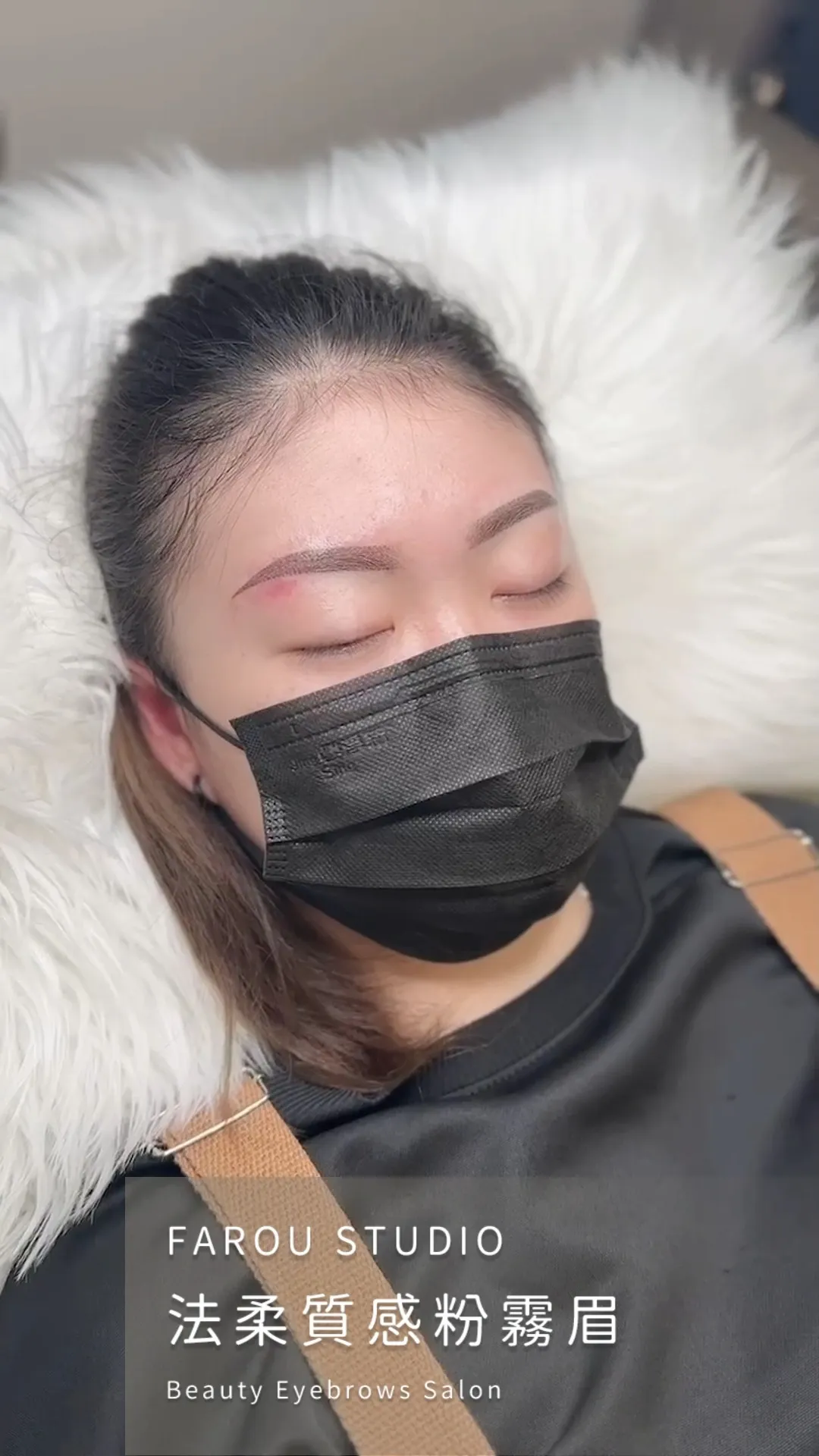 霧眉會痛嗎？