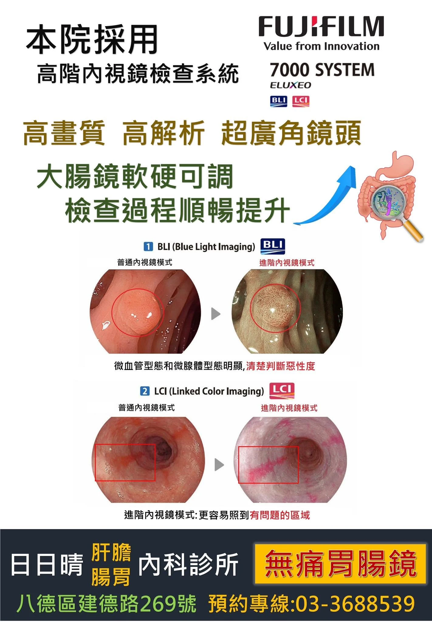 本院採用 高階內視鏡檢查系統