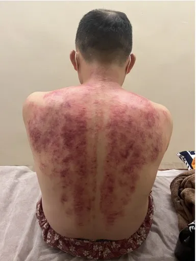 全身按摩送刮痧
