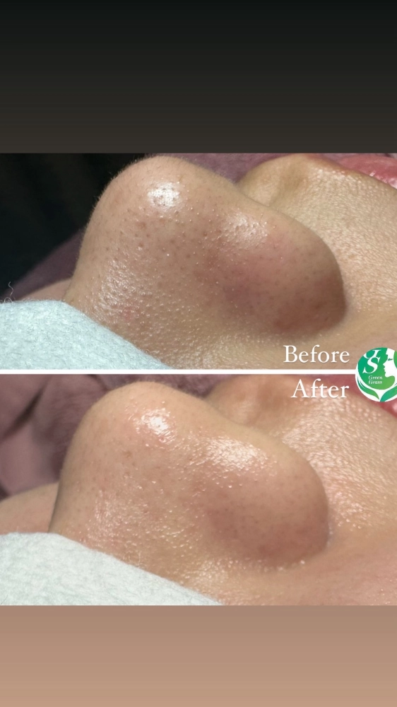 臉部保養｜桃園做臉、桃園做臉推薦