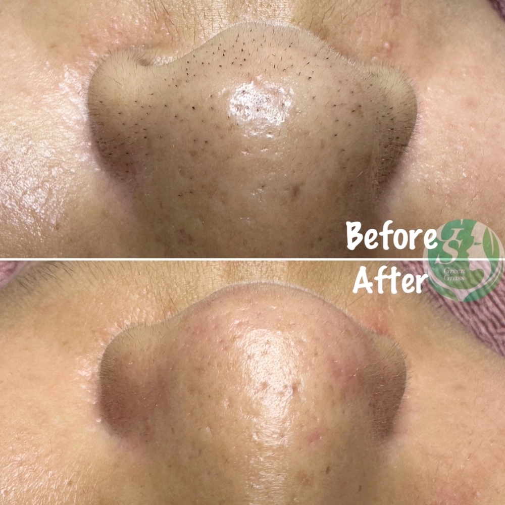 臉部保養｜桃園做臉、桃園做臉推薦