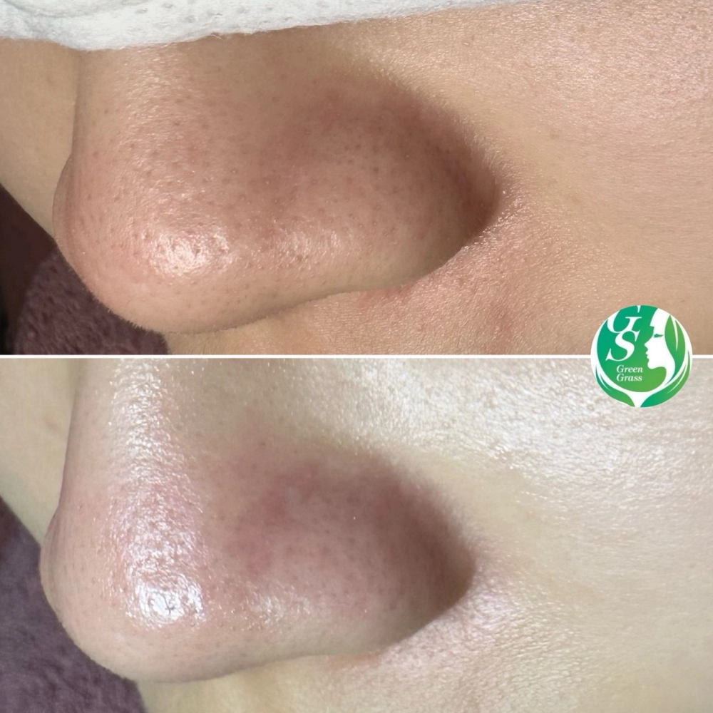 臉部保養｜桃園做臉、桃園做臉推薦