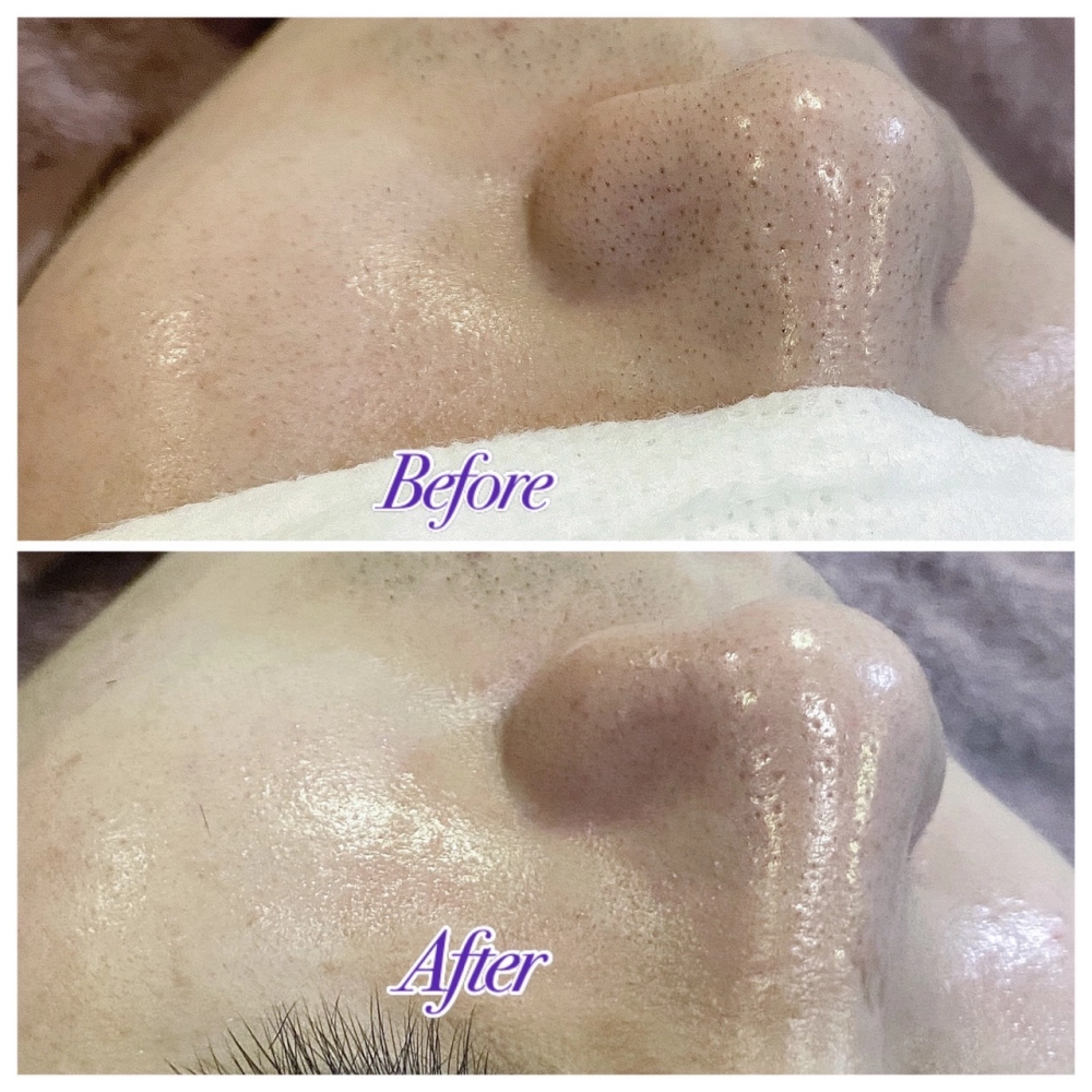 臉部保養｜桃園做臉、桃園做臉推薦