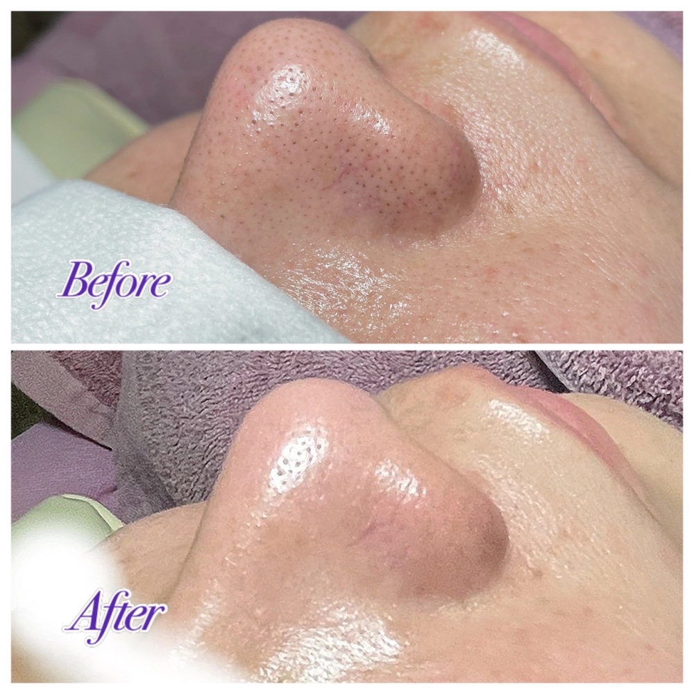 臉部保養｜桃園做臉、桃園做臉推薦