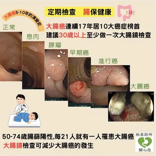 恐怖文明病--大腸癌