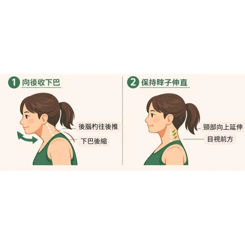 烏龜頸如何改善？