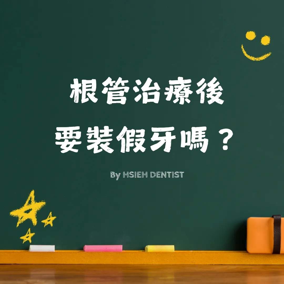 根管治療後要裝假牙嗎？