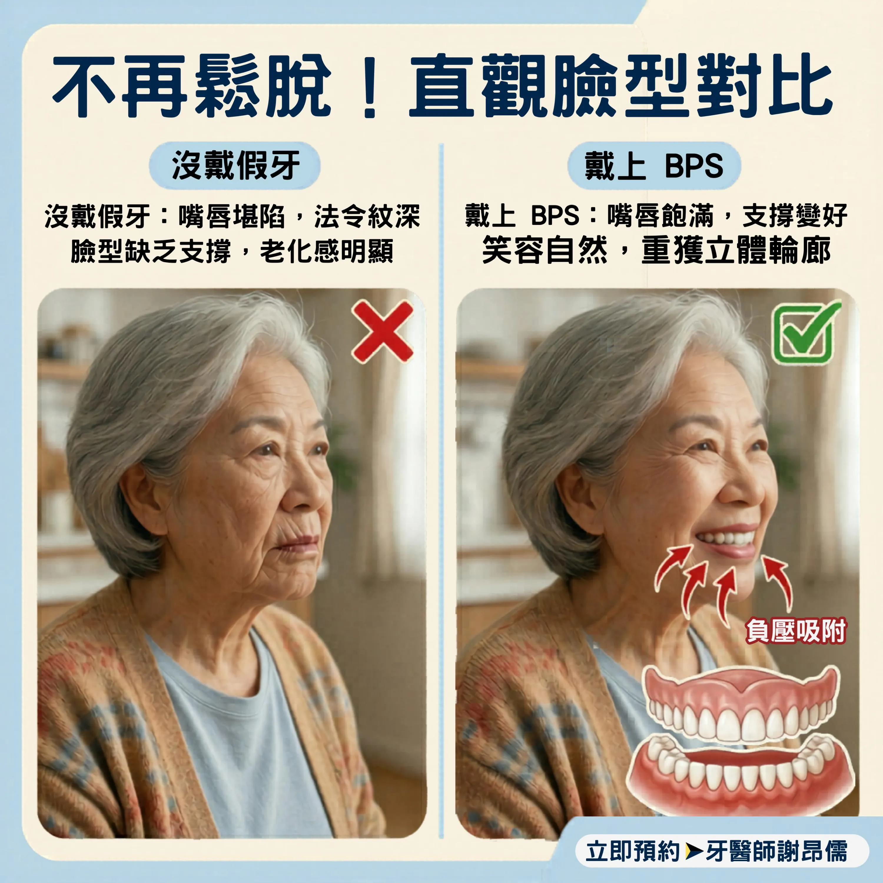 沒牙齒老很快？BPS 不只補牙，更能撐起您的年輕臉型！｜三重BPS吸附式假牙｜三重BPS吸附式假牙推薦｜三重吸附式假牙｜台北BPS吸附式假牙｜台北BPS吸附式假牙推薦｜台北吸附式假牙