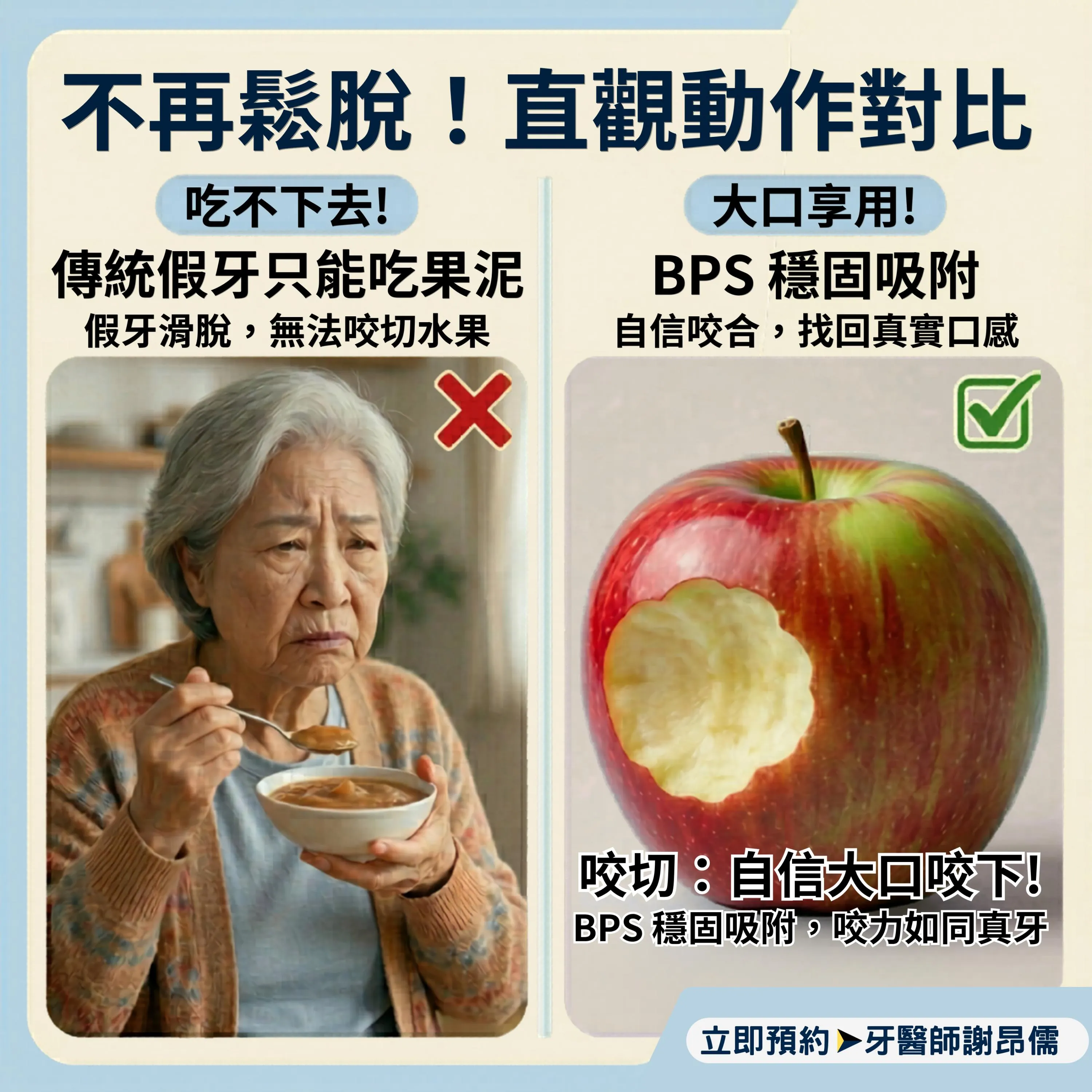 只能看著蘋果嘆氣？BPS 讓您重拾「啃」的快感！｜三重BPS吸附式假牙｜三重BPS吸附式假牙推薦｜三重吸附式假牙｜台北BPS吸附式假牙｜台北BPS吸附式假牙推薦｜台北吸附式假牙
