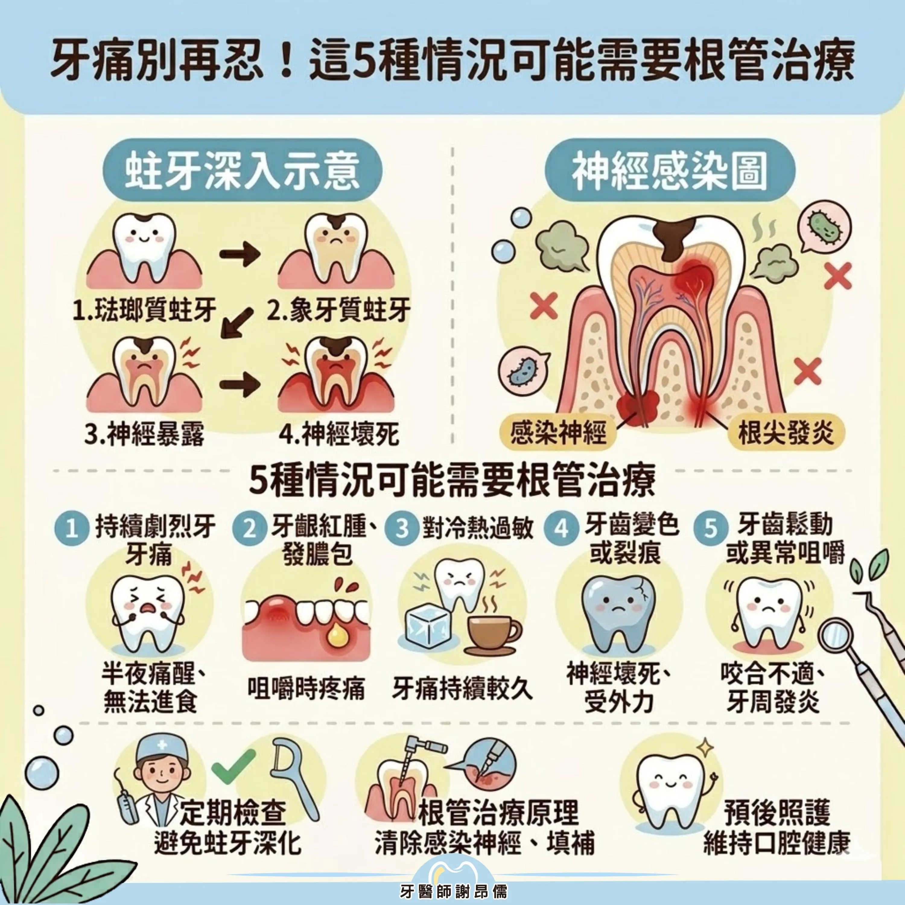 【痛點解析】這 5 種情況可能需要「抽神經」？謝昂儒醫師談根管治療的重要性｜三重牙醫｜三重牙醫診所｜三重牙醫推薦｜台北牙醫｜台北牙醫診所｜台北牙醫推薦